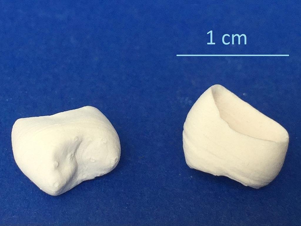 Corone dentali ceramiche da stampa DLP 