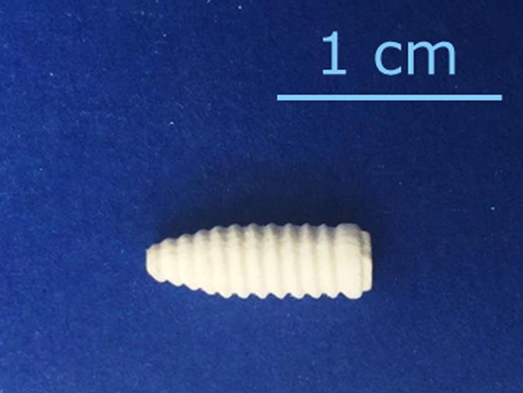 Perno dentale in ceramico da stampa DLP 